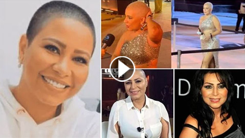 5 نجمات حلقن شعرهن على الزيرو! آخرهن أسما شريف منير وشيرين عبد الوهاب..