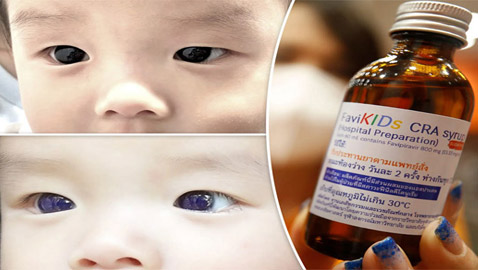 بسبب عقار مضاد لكورونا.. عينا طفل تحولتا من البني للأزرق