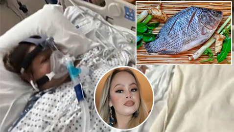 سيدة تفقد أطرافها الأربعة بعد تناولها وجبة سمك