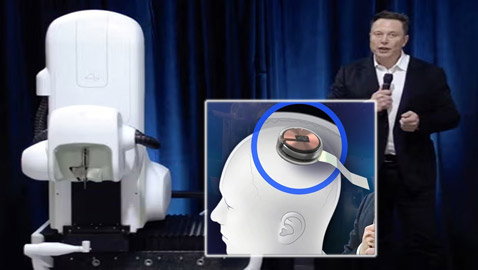 شركة إيلون ماسك ستزرع رقائق إلكترونية بالأدمغة! يبحثون عن متطوعين للتجارب