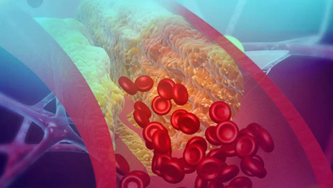 لتحسين مستويات الكولسترول وصحة القلب.. 5 تغييرات في نمط الحياة