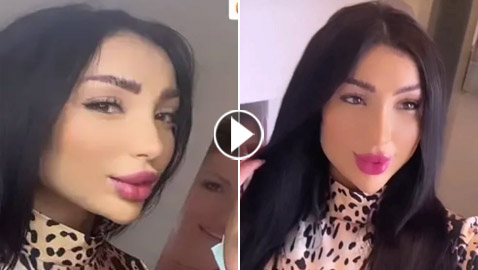 فيديو دنيا بطمة تحقن وجهها وتنفخ شفتيها وتتغزل بنفسها، والجمهور: مهووسة عمليات تجميل وشوهت شكلها!