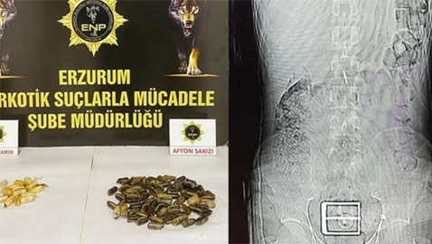 خبأ 95 كبسولة مخدرة بمعدته وأمعائه.. والسلطات بتركيا كشفته