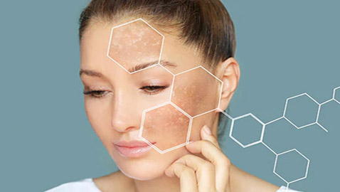 هذان المكونان هما الأفضل للتخلص من البقع الداكنة