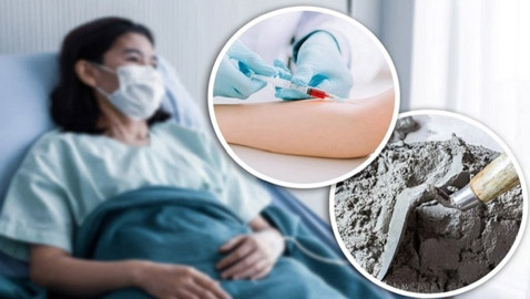 علاج غريب بالإسمنت لسرطان الثدي يتسبب بوفاة امرأة
