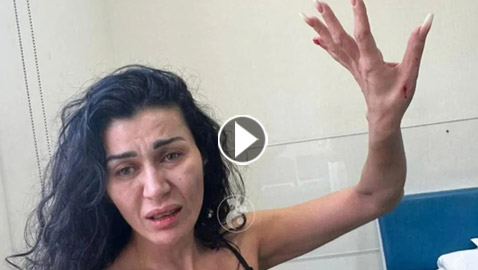 نادين الراسي تتعرض للضرب وجروح في الرأس واليد.. والصدمة ان المعتدي هو شقيقها الأصغر!
