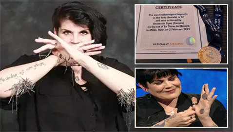 لديها قدرات خارقة.. سيدة تعيش بـ52 شريحة إلكترونية في جسدها (صور)