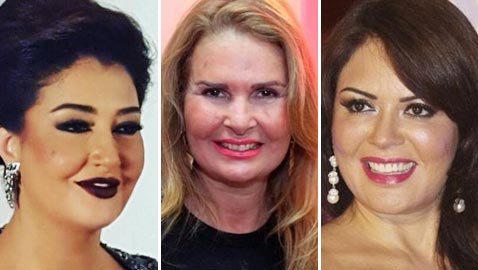 عمليات تجميل فاشلة شوهت الفنانات العربيات بينهن يسرا، غادة وكارمن