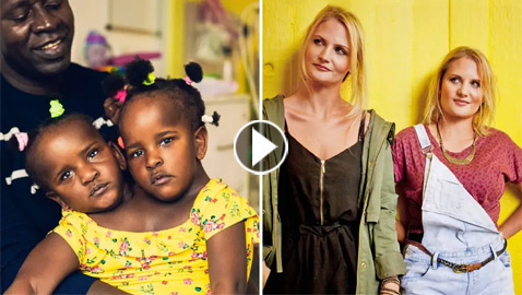 فيديو وصور: 6 من أغرب أنواع التوائم وأندرها في العالم