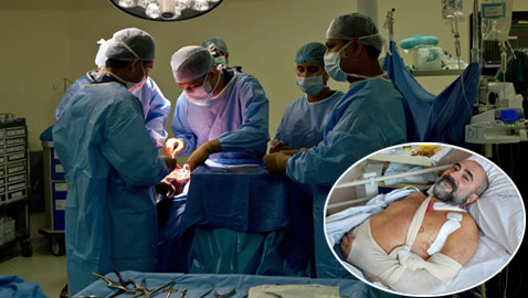 لأول مرة في العالم.. إعادة الحركة ليد مشلولة بزرع أعصاب من الساق