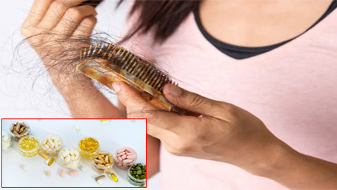 6 فيتامينات نقصها بالجسم يرتبط بتساقط الشعر