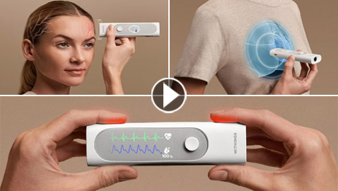 طبيب متنقل.. أول منظار متعدد لإجراء فحص طبي شامل من المنزل (فيديو وصور)