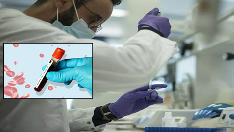 الطريقة المعتمدة في تصنيف السرطانات باتت قديمة.. ما السبب؟