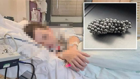 تحدي تيك توك ينهي حياته.. طفل يبتلع 10 مغناطيسات ليبهر متابعيه!