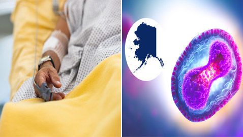 فيروس جديد يقتل أول مصاب به.. ماذا نعرف عن (جدري آلاسكا) ونصائح السلطات الصحية لتجنبه