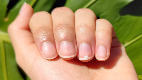 من لون أظافرك.. يمكنك التعرف على حالتك الصحية