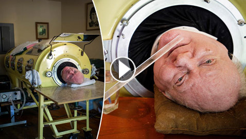 عاش بهيكل معدني لعقود.. وفاة رجل (الرئة الحديدية) عن 78 عاما ويثر الحزن عالميا