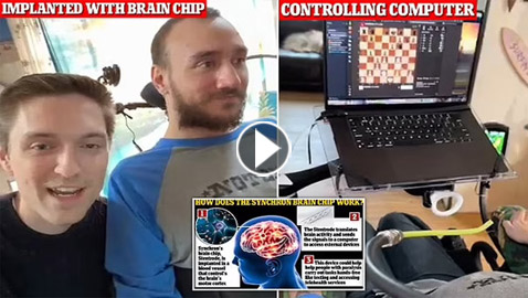 ماسك ينشر فيديو لأول إنسان خضع لزراعة شريحة بدماغه.. يتحكم بالكمبيوتر بذهنه