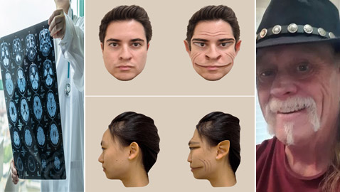 رجل مصاب بحالة نادرة وعجيبة تجعله يرى الجميع بهيئة العفاريت، ماذا قال الأطباء؟