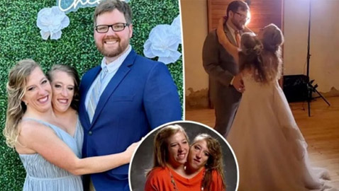 الكشف عن زواج أشهر توأم ملتصق في العالم