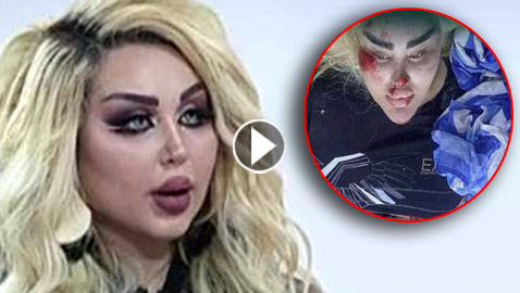 فيديو اختطاف داليا نعيم (باربي العراق) ببغداد ورموها من السيارة! عليها آثار ضرب وحروق!