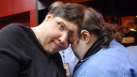 عاشا 24 عاما بمصحة عقلية وتوقعوا موتهما بعمر الـ30.. وفاة أكبر توأم ملتصق بالعالم