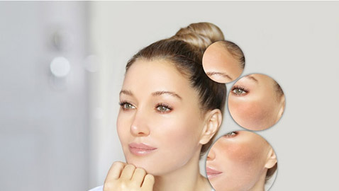 حيل للتخلص من البقع الصبغية على الوجه تغنيك عن العلاجات التجميلية