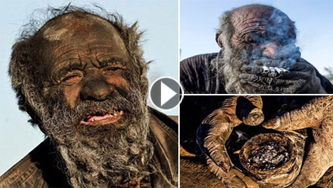 تعرفوا على قصة أقذر رجل في العالم.. اغتسل بعد 60 عاما ومات!