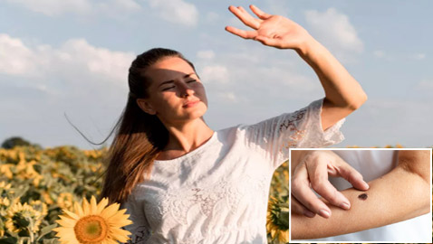 في شهر التوعية بسرطان الجلد..7 نصائح تقي من الإصابة