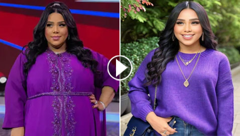 شيماء سيف: أجريت عملية تكميم المعدة وخسرت 50 كغم من وزني! صور قبل وبعد