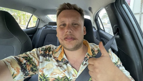 فاكهة مكسيكية غريبة تحرق وجه سائح بريطاني