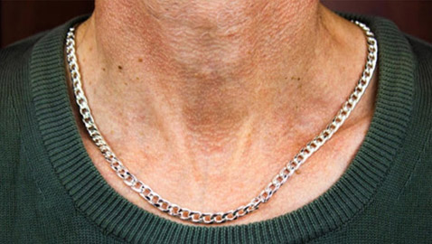 قلادة معدنية تنقذ أمريكياً من 