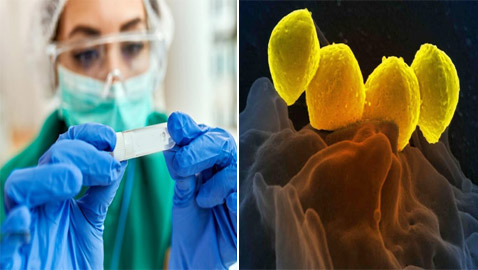 تنهش اللحم وتقتل بساعات.. رعب من انتشار بكتيريا جديدة!