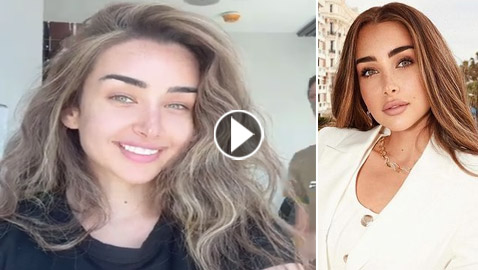 هنا الزاهد تجري عملية تجميل لأسنانها بعد تعرضها للتنمر!