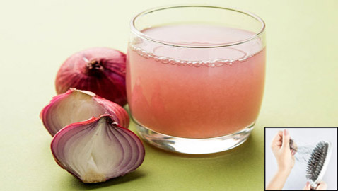 وصفة سحرية.. عصير البصل يحارب تساقط الشعر ويعزز نموه