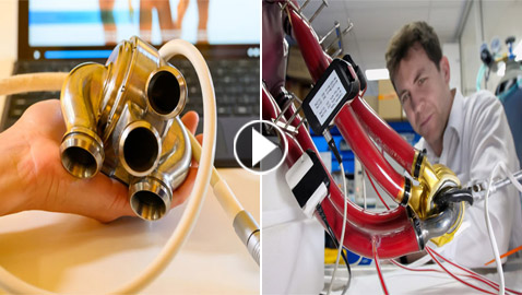 لأول مرة.. زراعة قلب من التيتانيوم بصدر مريض حي (فيديو وصور)