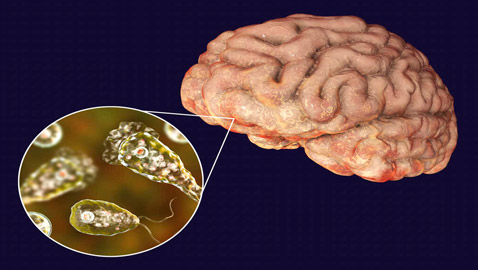 العلماء يدقون ناقوس الخطر من الأميبا.. عدوى 