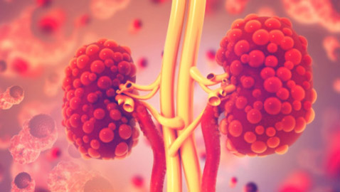 5 علامات غير عادية لتلف الكلى.. لا تتجاهلها