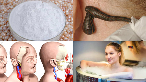 تعرفوا إلى أغرب 10 علاجات وإجراءات طبية اتبعها الأطباء حول العالم