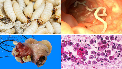 بالصور: تعرفوا على الكائنات الحية التي تعيش بداخل جسم الإنسان!