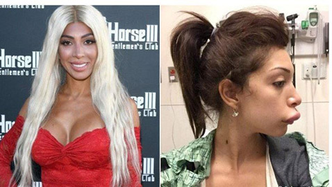 صور عمليات تجميل جنونية: امرأة أصبحت قطة ومهووس تحول لسوبر مان 