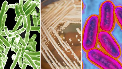 تعرفوا إلى أخطر الجراثيم والبكتيريا القاتلة والمقاومة للأدوية في العالم