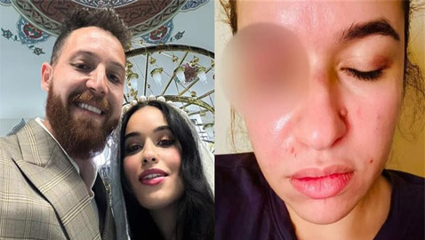 حكم بسجن فنان مصري لمدة  6 أشهر بسبب اعتدائه بالضرب على زوجته